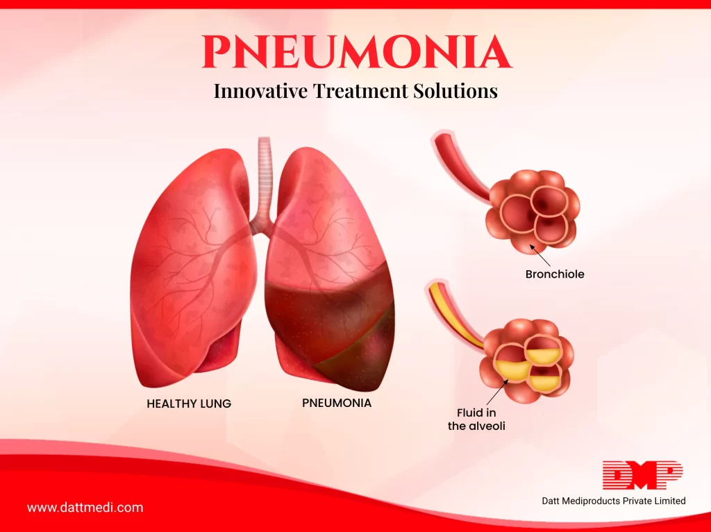 Pneumonia and its Innovative Treatment Solutions