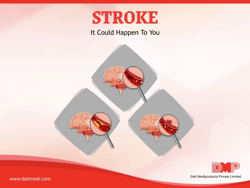 STROKE ACT FAST