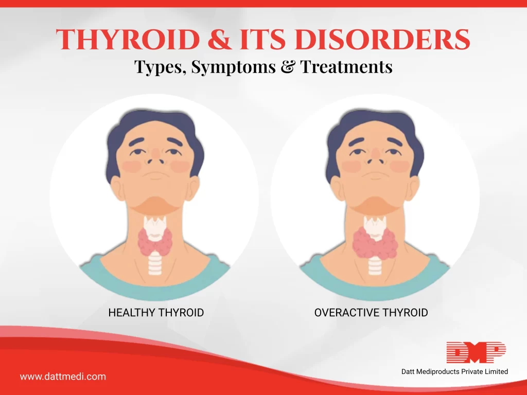 All You Need to Know about Thyroid & its Disorders!