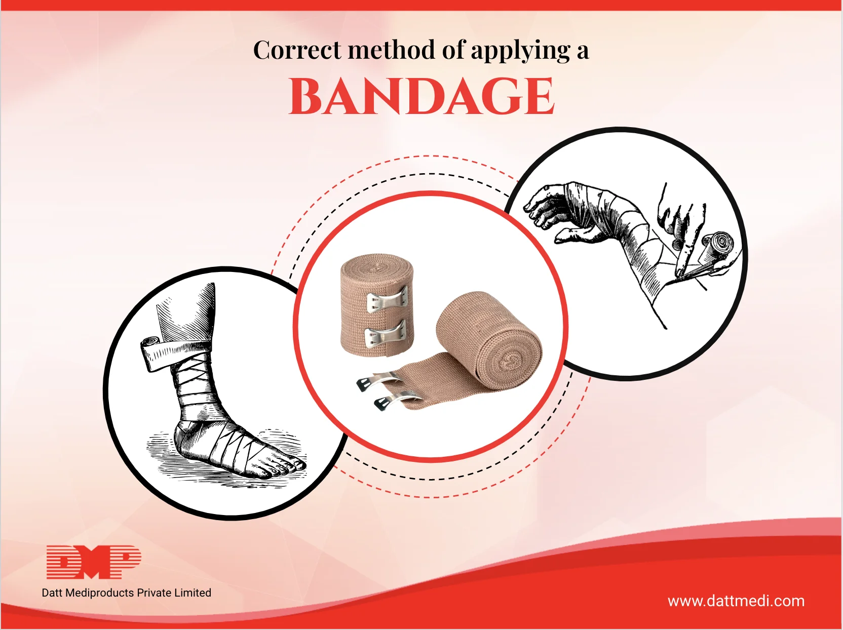 Correct method of applying a bandage