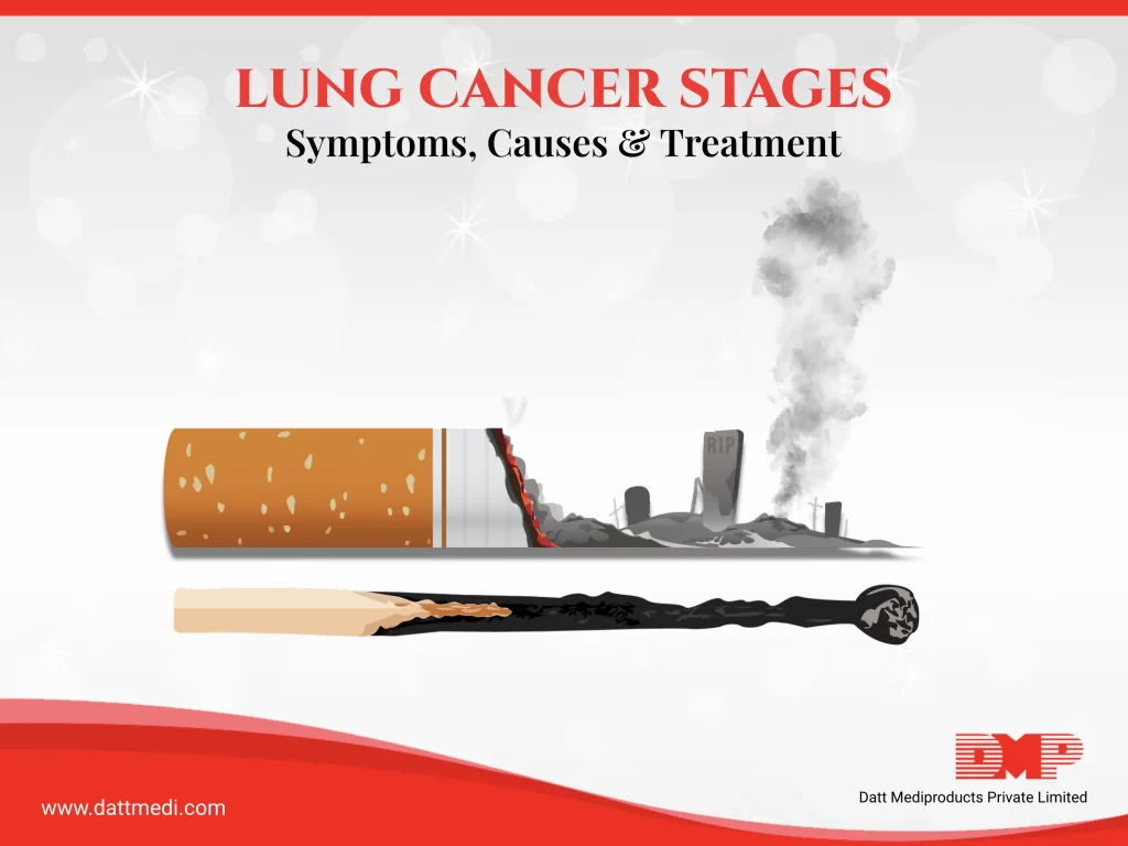 Know the Stages of Lung Cancer