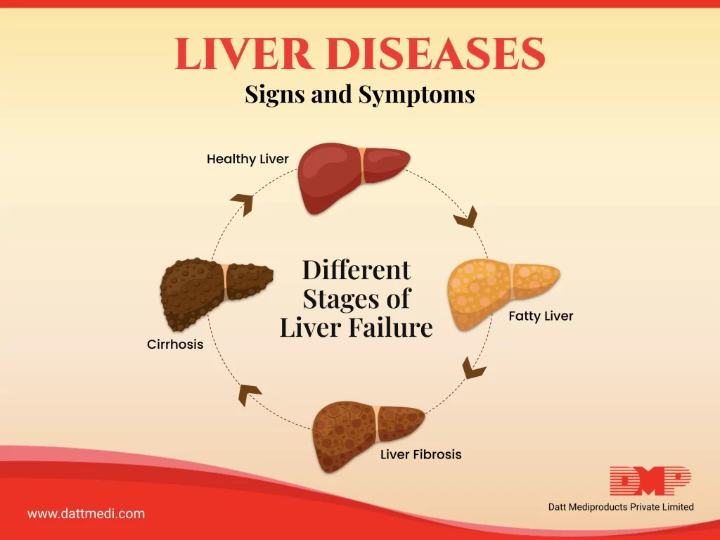Liver Diseases & Signs