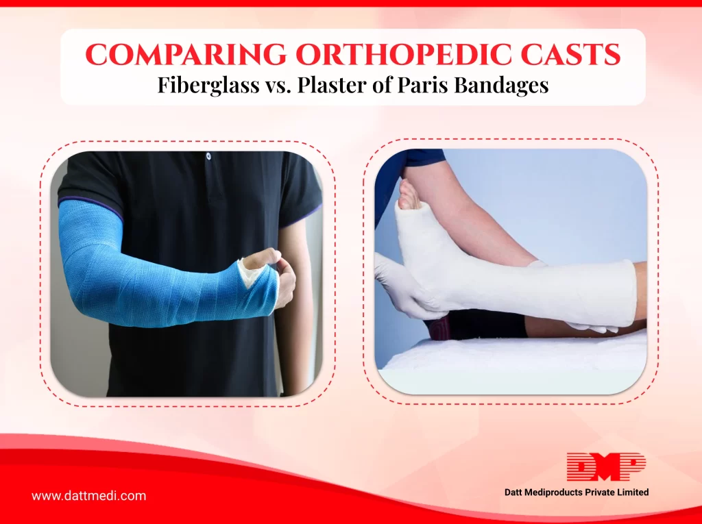 Comparing Orthopedic Casts