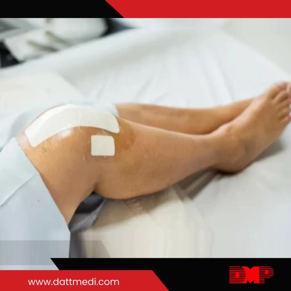 Velfix® T+Pad post-operative film dressing with absorbent pad